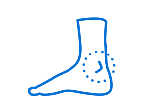 Foot Ankle